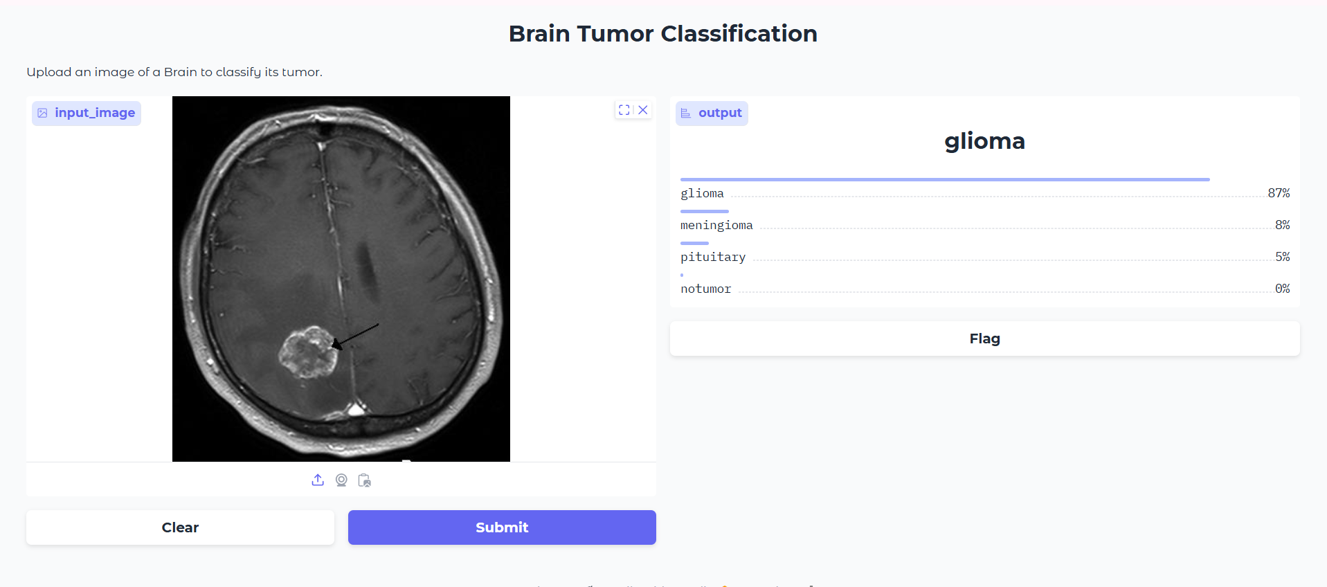 Brain Tumor Classification AI